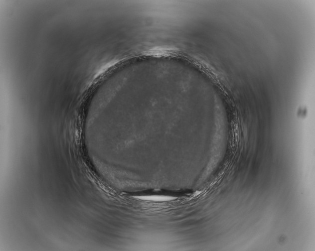 X0000099311158200805231357