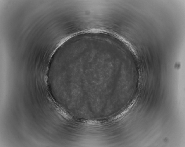 X0000099311170200805231357