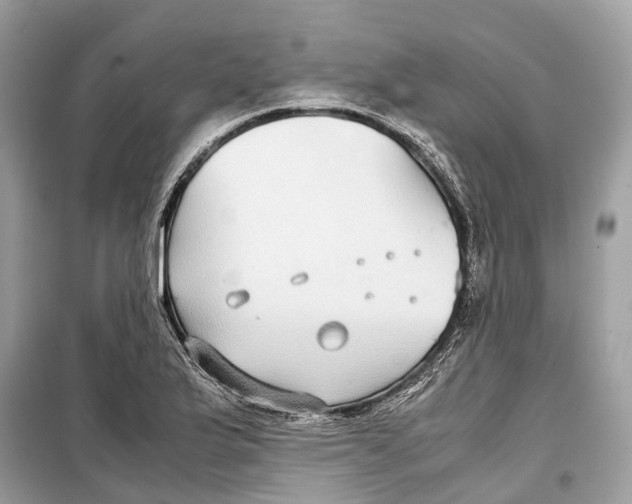 X0000099311175200805231357