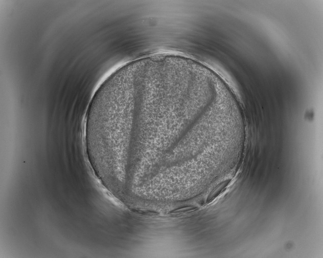 X0000099311198200805231356