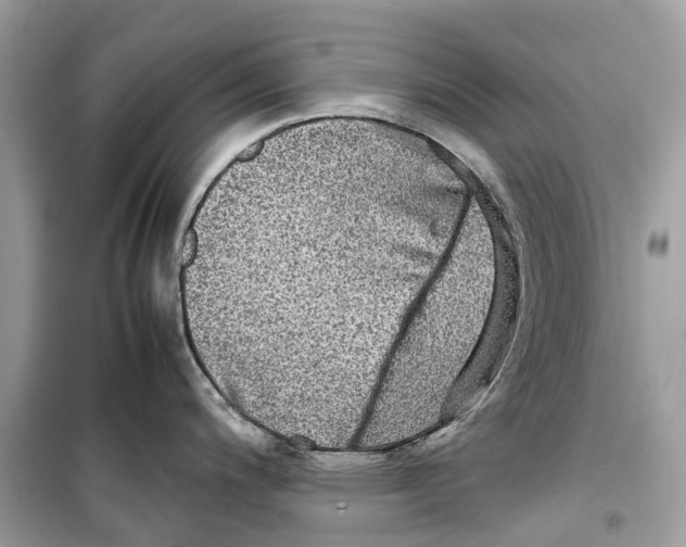 X0000099311200200805231356