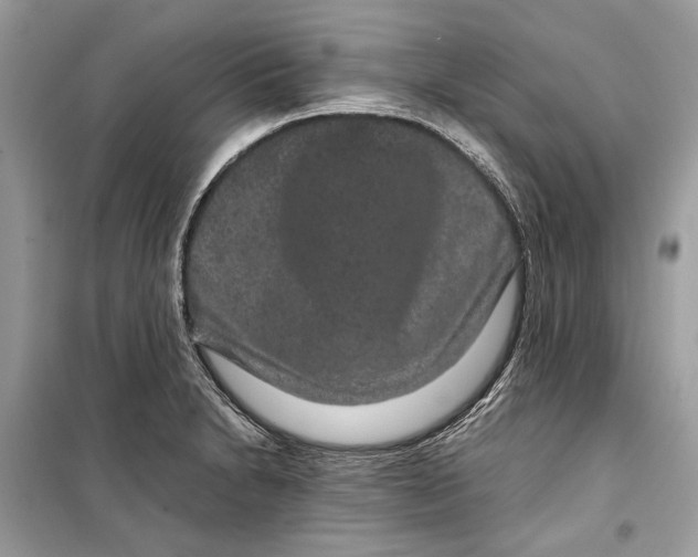 X0000099311230200805231356