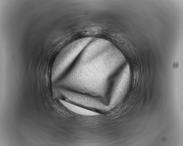 X0000099311250200805231356