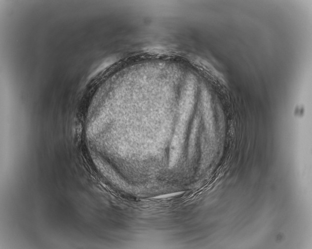 X0000099311302200805231354