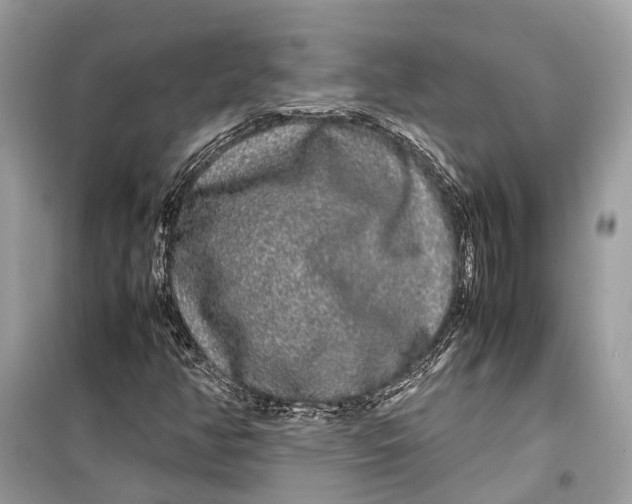 X0000099311350200805231354