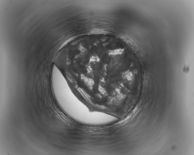 X0000099311401200805231353