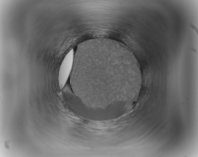 X0000099310041200805301203