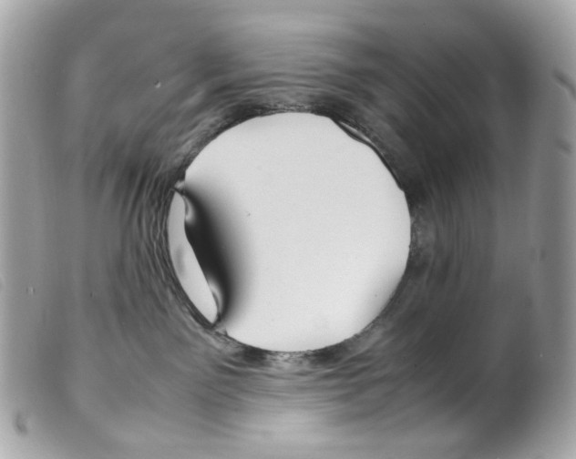 X0000099310141200805301202