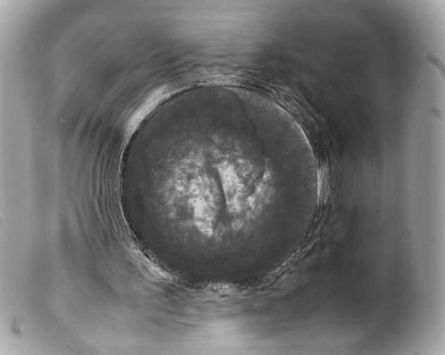 X0000099310195200805301201