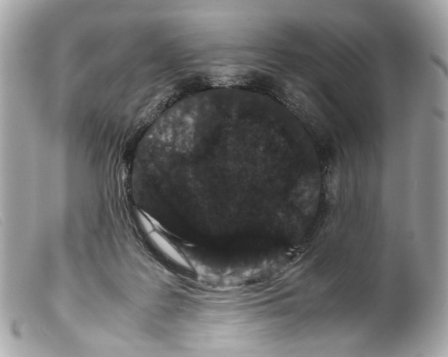X0000099310219200805301201