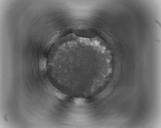 X0000099310336200805301159