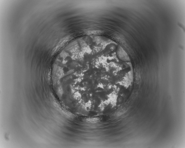 X0000099310357200805301159