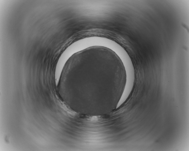 X0000099310382200805301159
