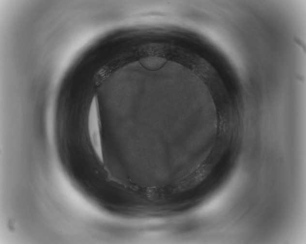 X0000099310383200805301159