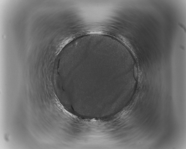 X0000099310385200805301159