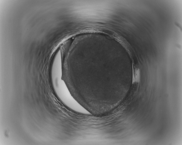 X0000099310387200805301159
