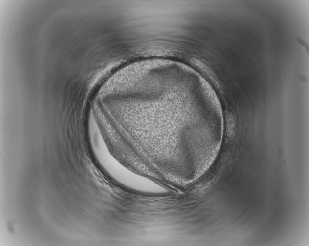 X0000099310395200805301158