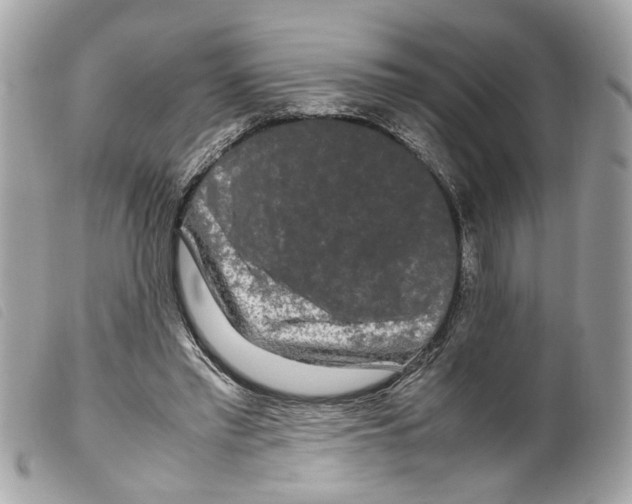X0000099310397200805301158
