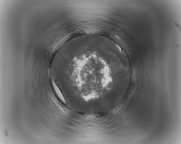 X0000099310405200805301158