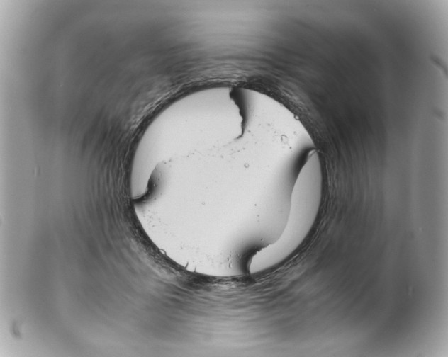 X0000099310411200805301158