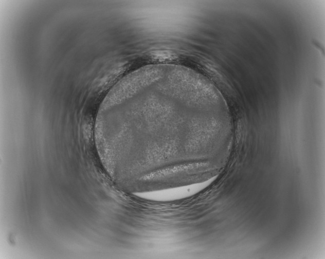 X0000099310417200805301158