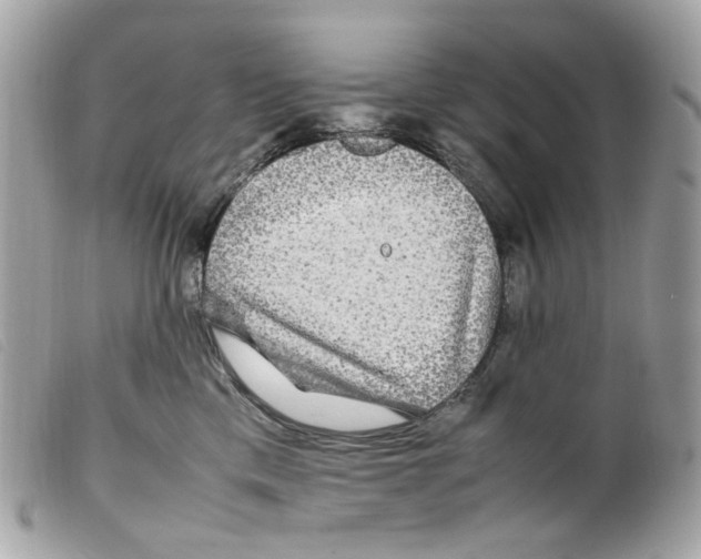 X0000099310425200805301158