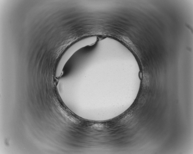 X0000099310441200805301157