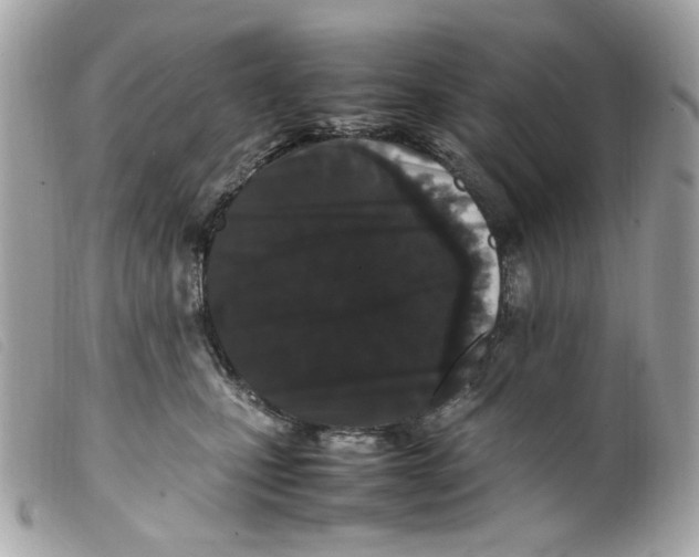 X0000099310471200805301158