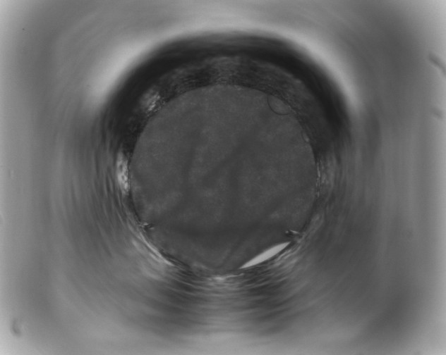 X0000099310479200805301158
