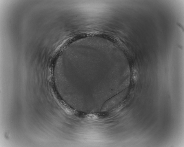 X0000099310519200805301157