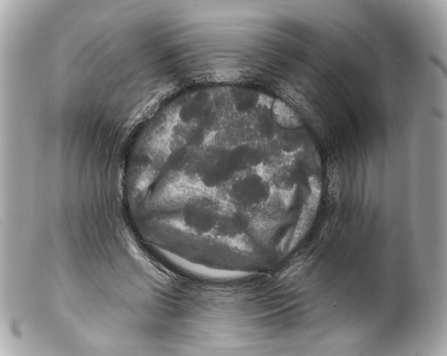 X0000099310542200805301156