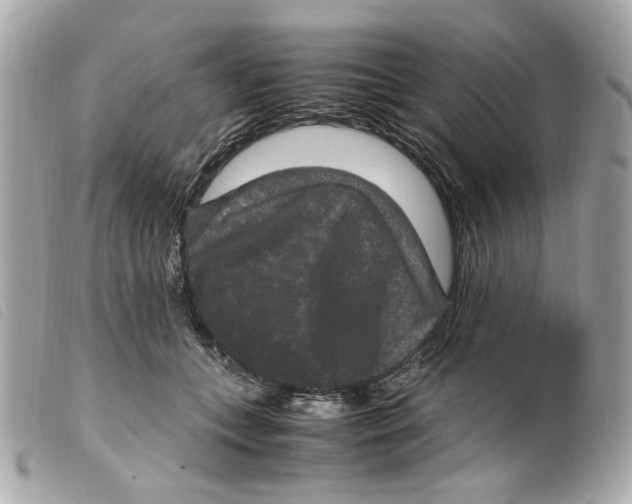 X0000099310559200805301156