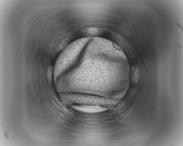 X0000099310562200805301156