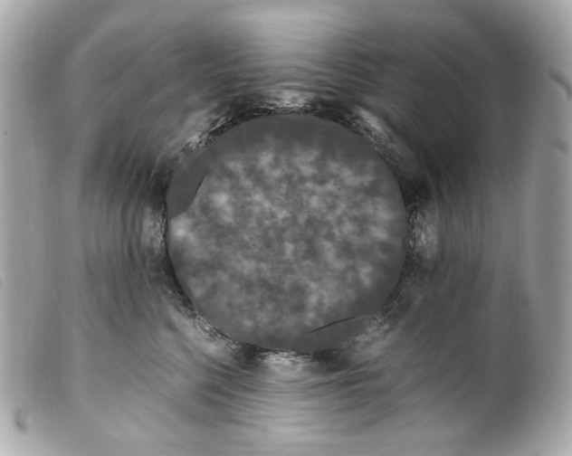 X0000099310568200805301156