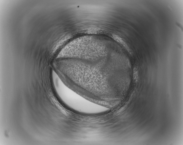 X0000099310589200805301156