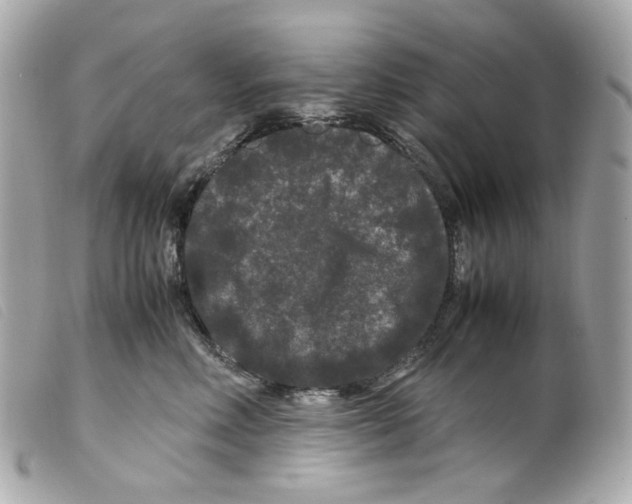 X0000099310618200805301155