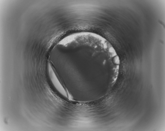 X0000099310640200805301155