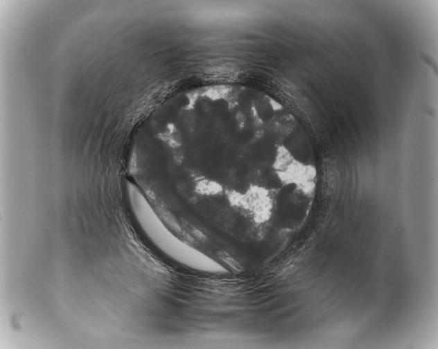 X0000099310641200805301155
