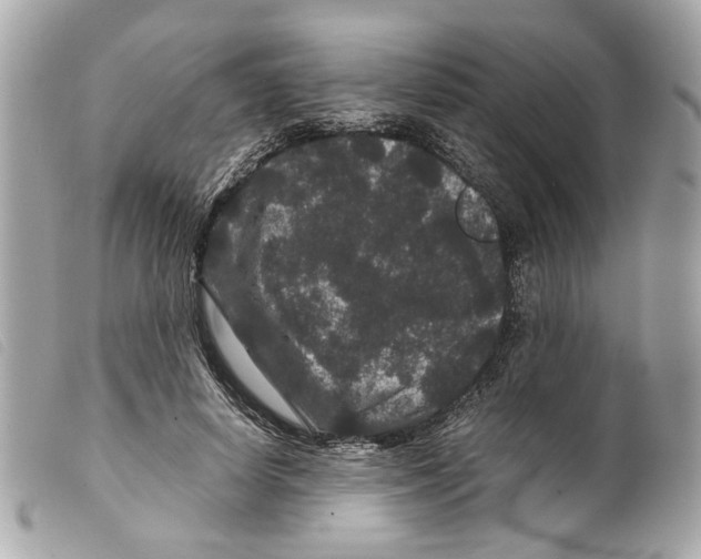 X0000099310642200805301155