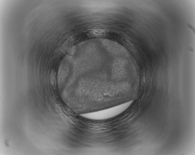 X0000099310651200805301155