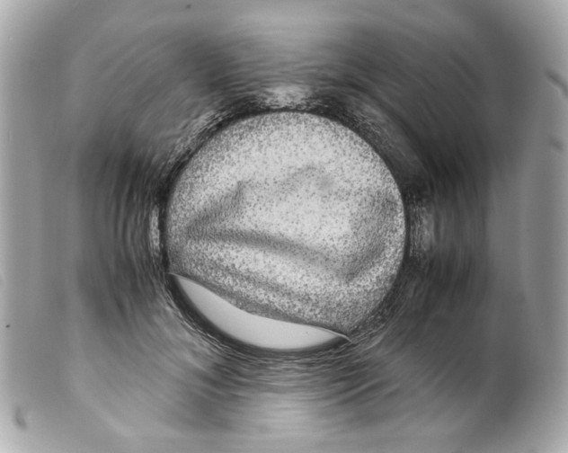 X0000099310700200805301154