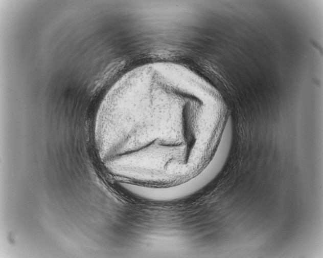 X0000099310738200805301154
