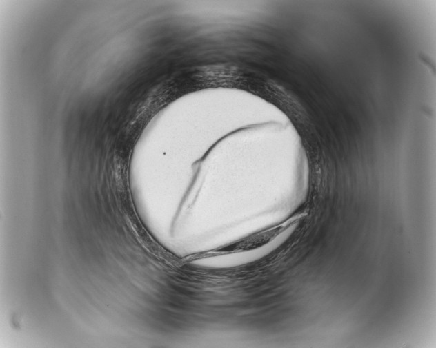 X0000099310757200805301154