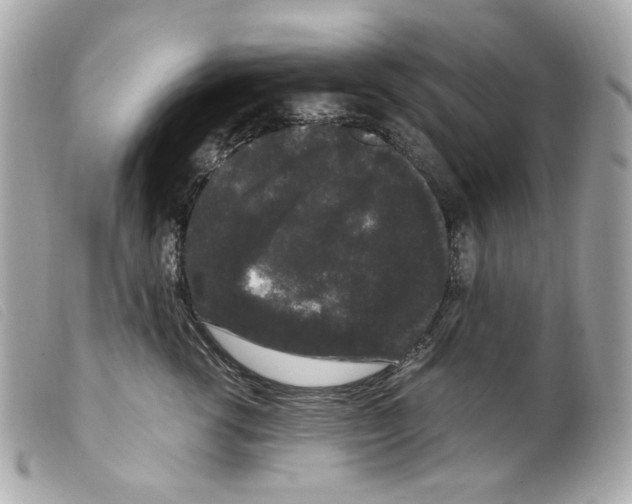 X0000099310762200805301154