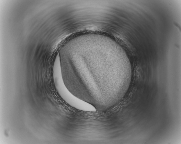 X0000099310776200805301153