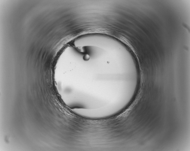 X0000099310781200805301153
