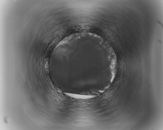 X0000099310818200805301152