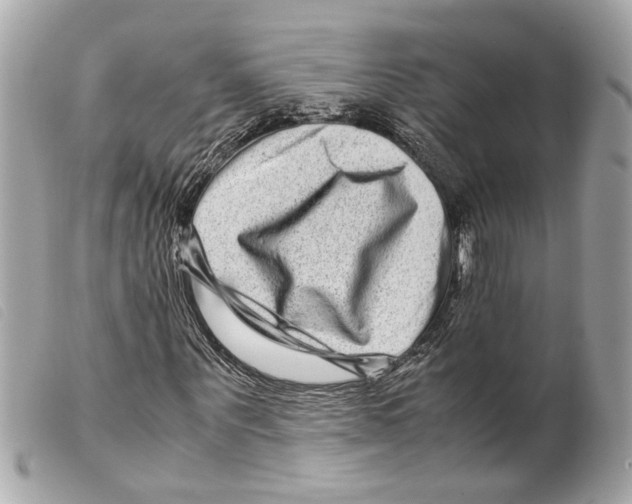 X0000099310867200805301152