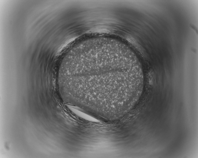 X0000099310872200805301152