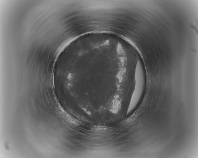 X0000099310935200805301151